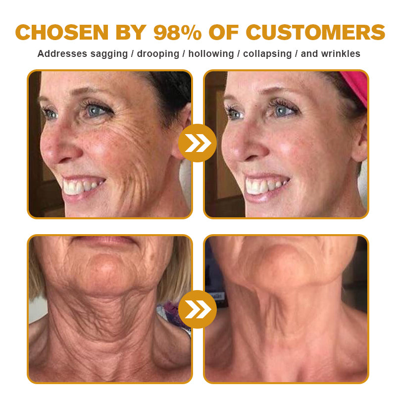 Last Day Promotion 80% OFF - ✨Furzero™ Bee Venom Wrinkle Removal Cream