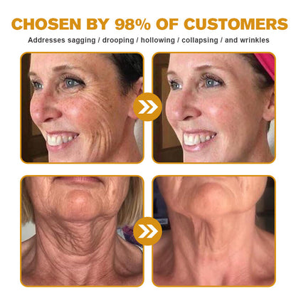 Last Day Promotion 80% OFF - ✨Furzero™ Bee Venom Wrinkle Removal Cream